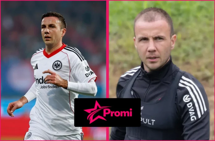mario götze haartransplantation